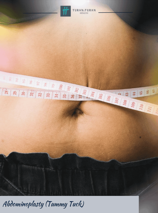 Abdominoplasty (Tummy Tuck)