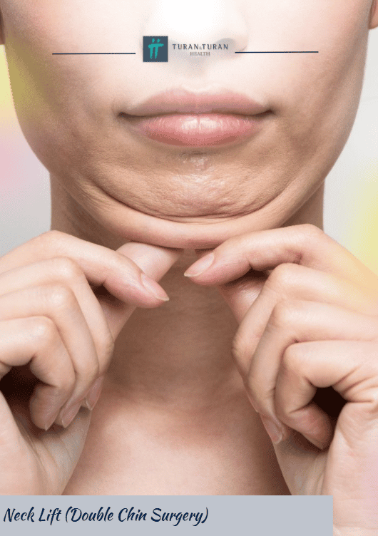 Neck Liposuction (Double Chin Liposuction)