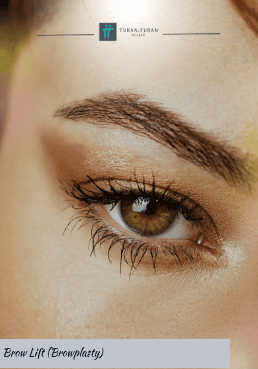 Brow Lift (Browplasty Surgery)