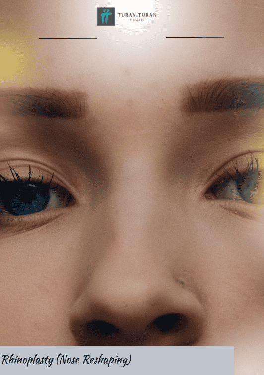 Rhinoplasty (Nose Reshaping) 