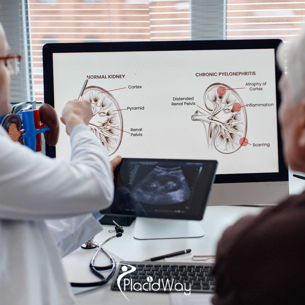 Stem Cell Therapy for Chronic Kidney Disease Package in Fort Lauderdale, USA by Regenestem