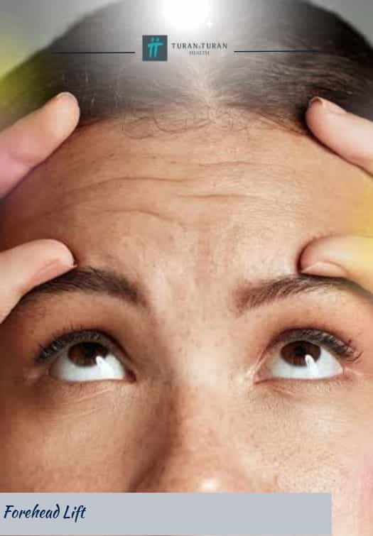 Forehead Lift Package in Istanbul, Turkey by Turan Turan