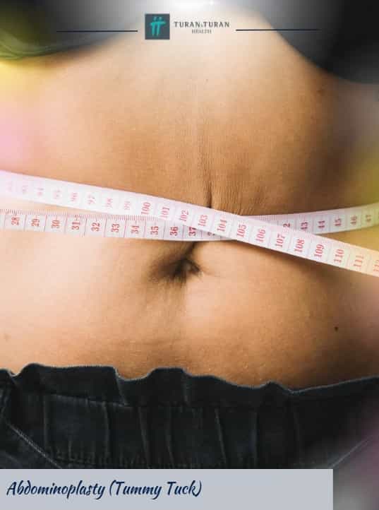 Tummy Tuck Package in Istanbul, Turkey by Turan Turan