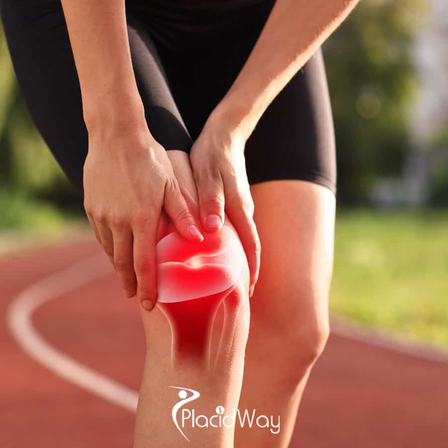 Knee Arthroscopy for Meniscus Surgery Package in Tijuana, Mexico by Dra. Brenda Delangel