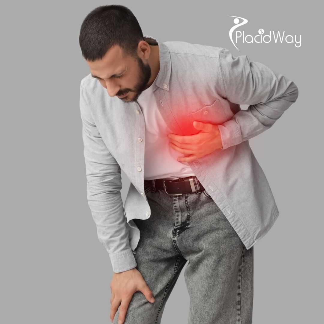 Angiography Package in Istanbul, Turkey by Bayindir Healthcare Group