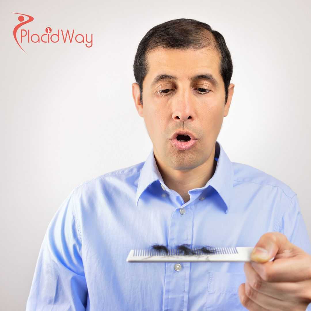 Personalized Stem Cell Therapy for Hair Loss Package in Mexico City, Mexico