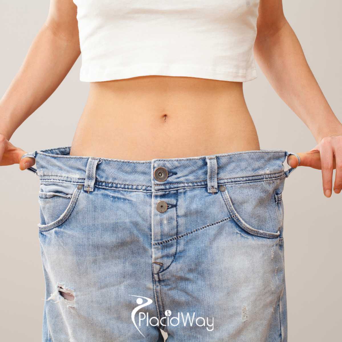 Duodenal Switch Surgery Package in Tijuana, Mexico
