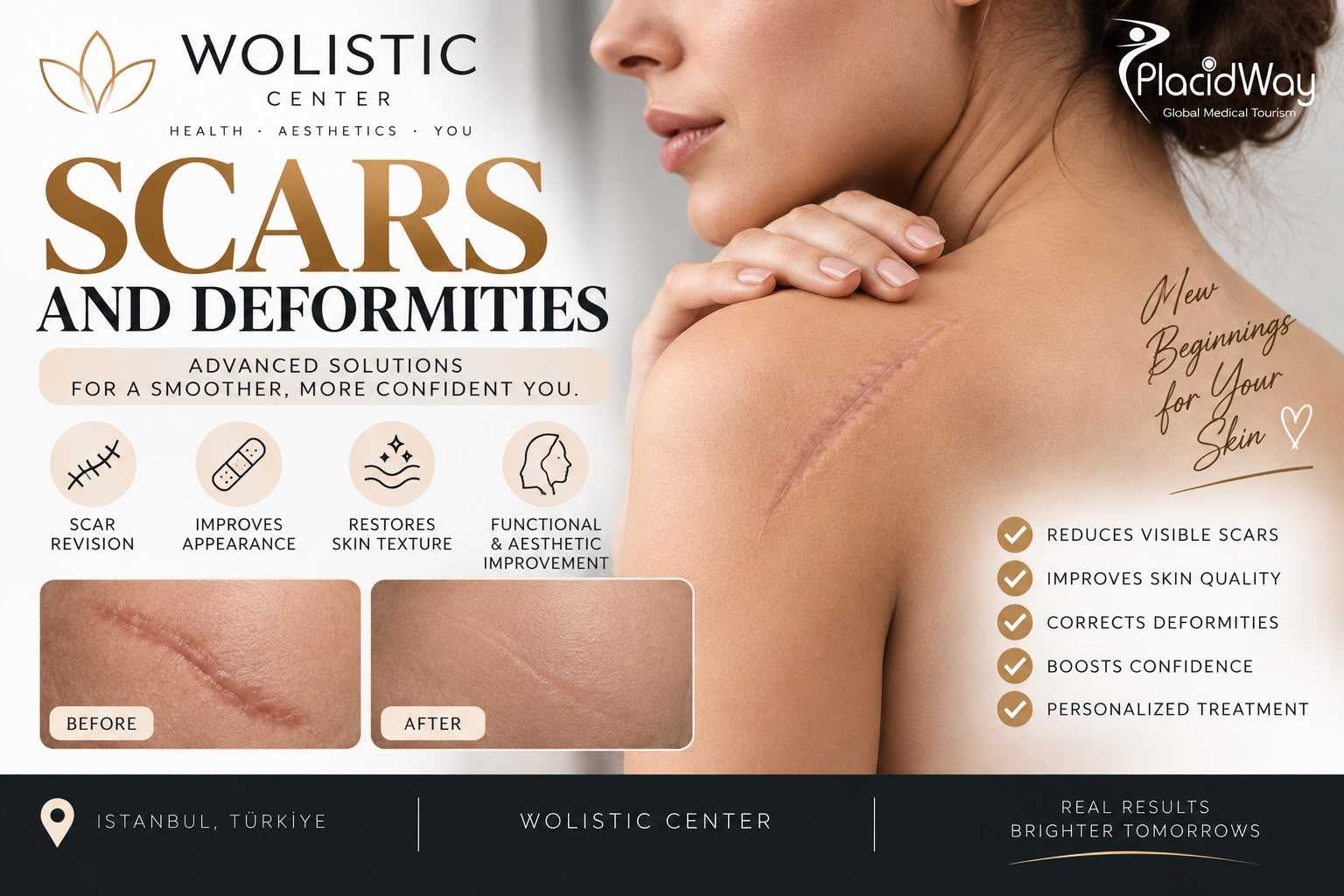 Scars and Deformities Package at Wolistic Center - Aesthetic & Wellness Clinic in Istanbul Turkey, Istanbul, Turkey