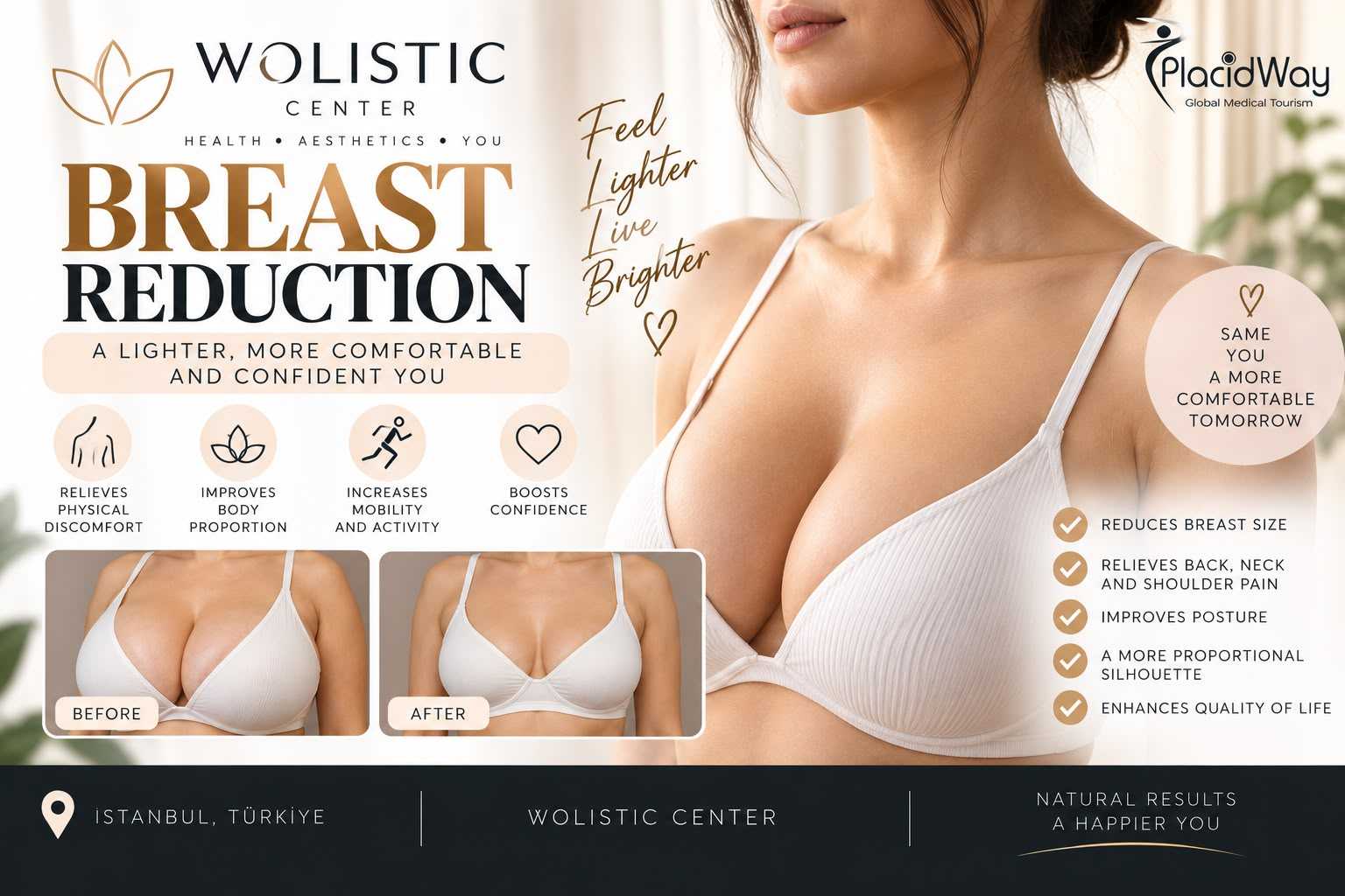 Breast Reduction Package at Wolistic Center - Aesthetic & Wellness Clinic in Istanbul Turkey, Istanbul, Turkey