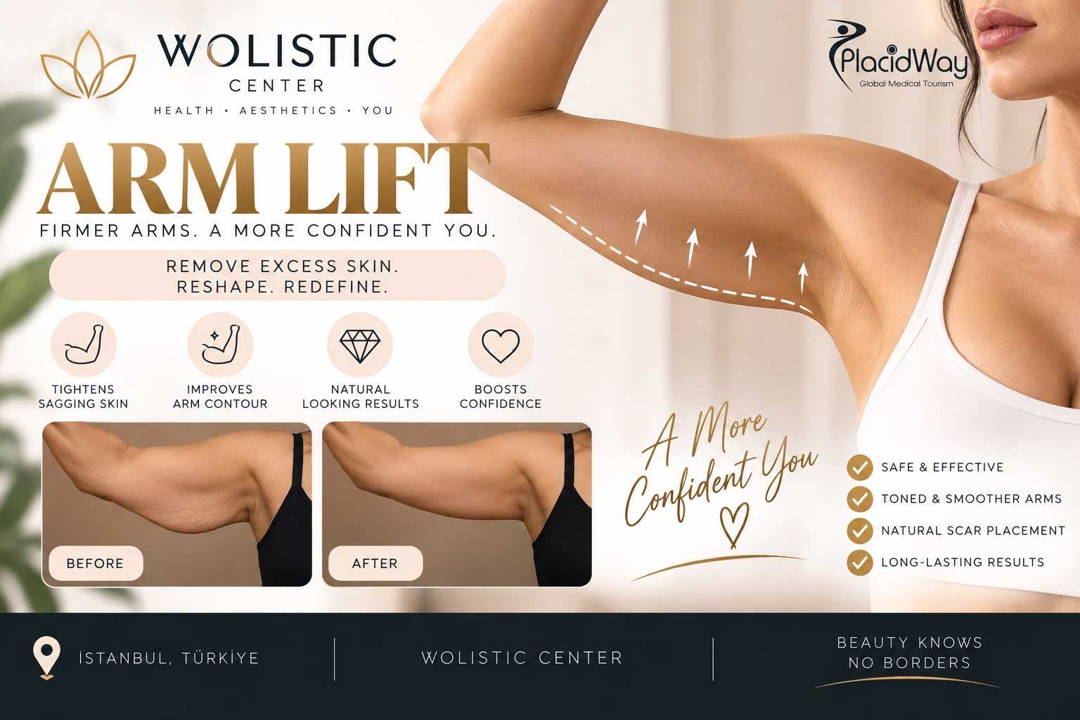 Arm Lift Package at Wolistic Center - Aesthetic & Wellness Clinic in Istanbul Turkey, Istanbul, Turkey