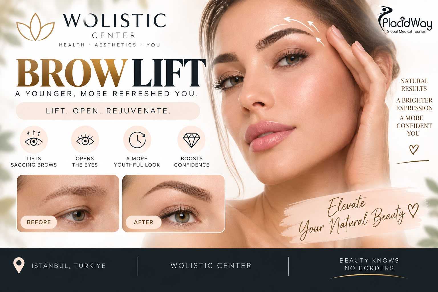 Brow Lift Package at Wolistic Center - Aesthetic & Wellness Clinic in Istanbul Turkey, Istanbul, Turkey