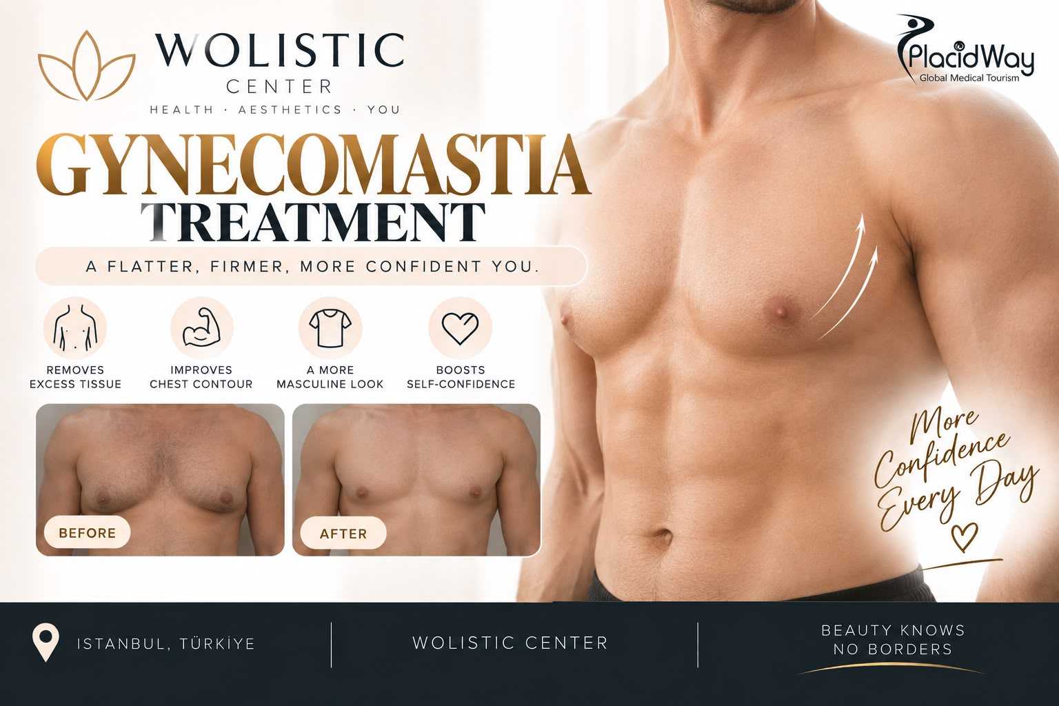 Gynecomastia Package at Wolistic Center - Aesthetic & Wellness Clinic in Istanbul Turkey, Istanbul, Turkey