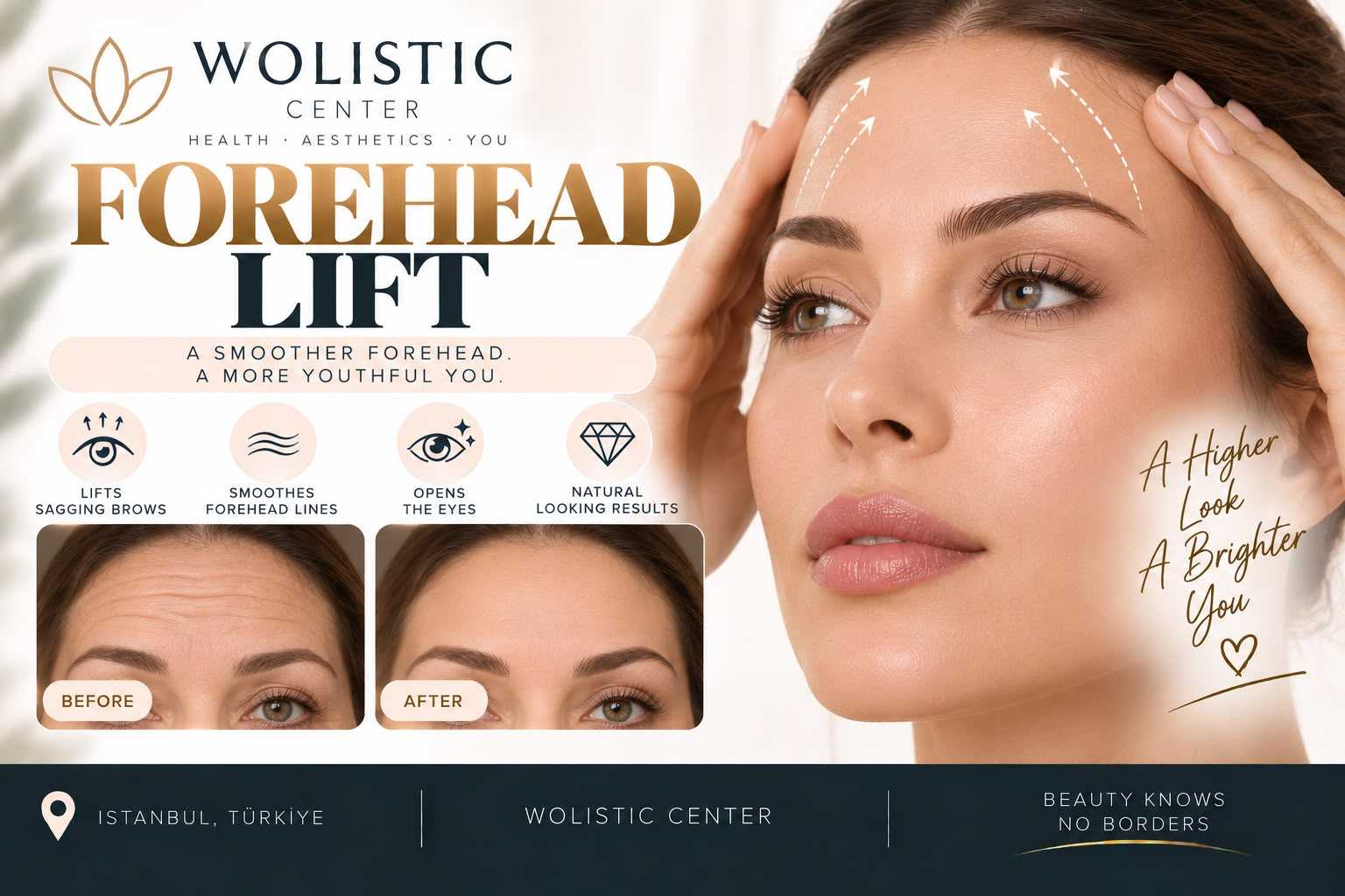 Forehead Lift Package at Wolistic Center - Aesthetic & Wellness Clinic in Istanbul Turkey, Istanbul, Turkey