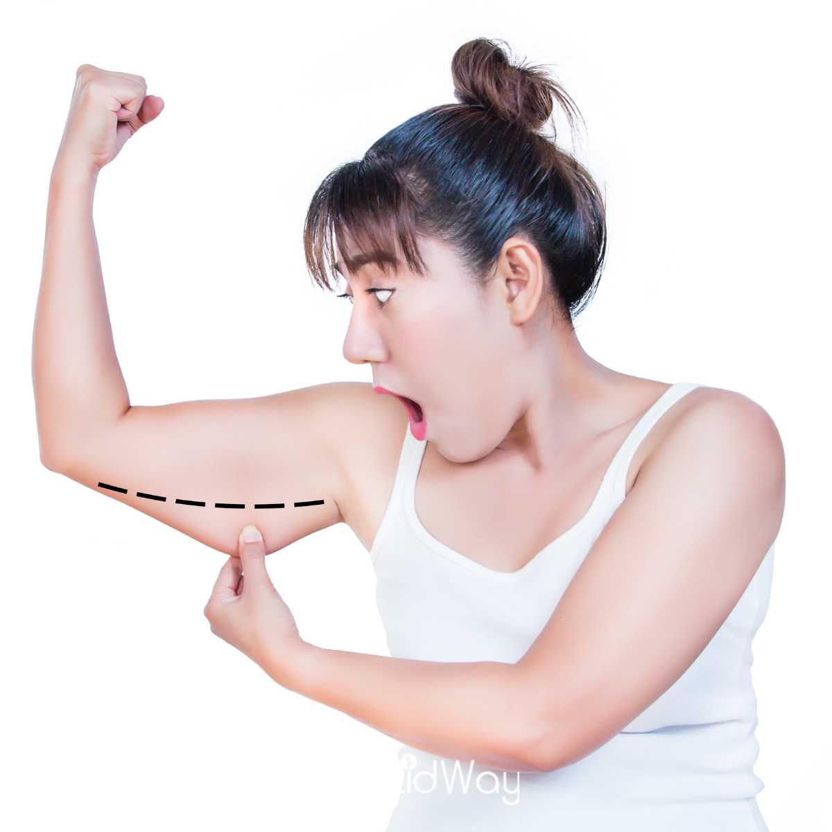 Brachioplasty Cost in Mexico – Exclusive Package in Mexico City with Dr. Ary Papadopulos