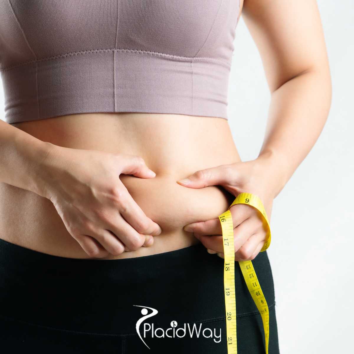 Best Package for Lap Band Surgery in Merida, Mexico - $5300