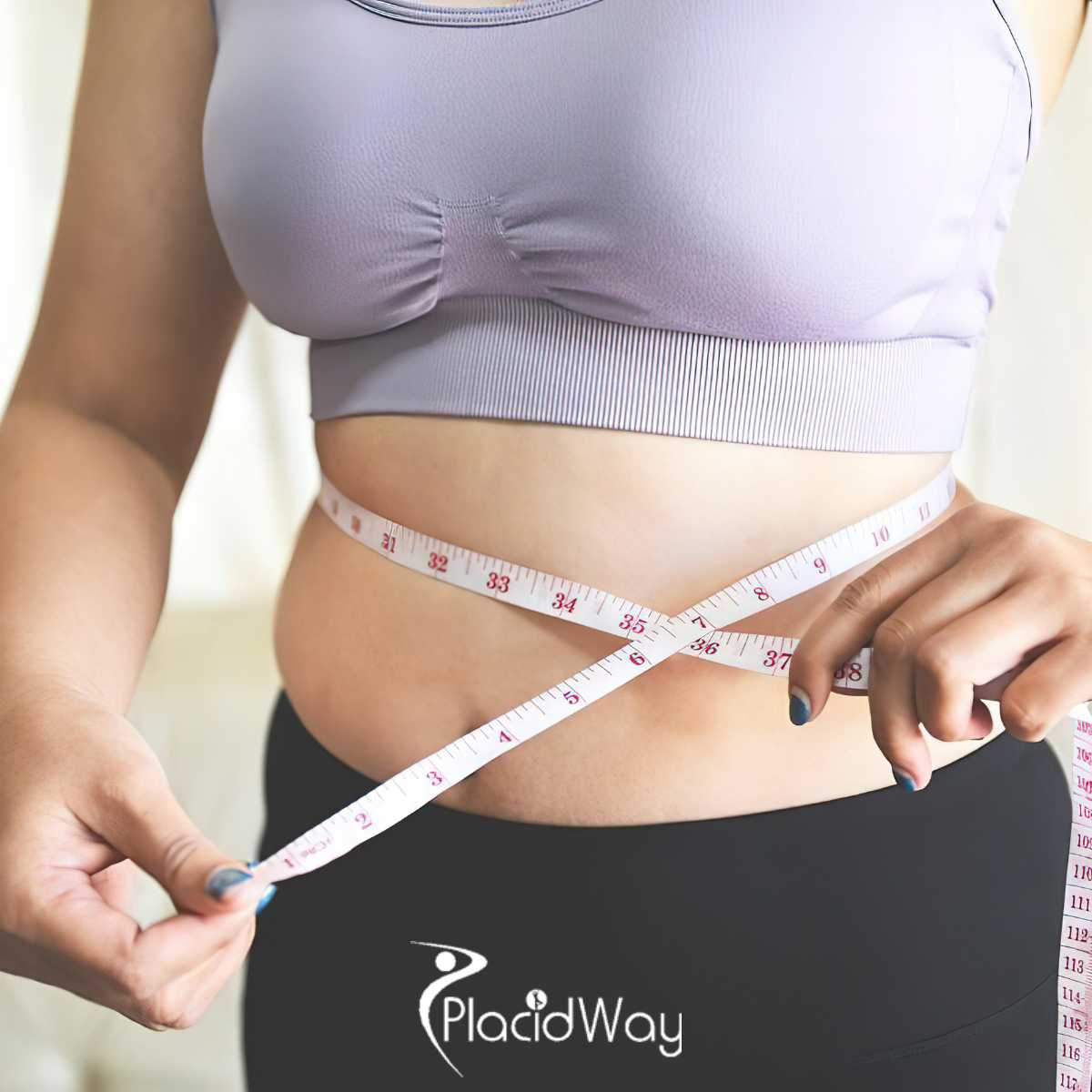 Gastric Bypass Surgery Package in Turkey