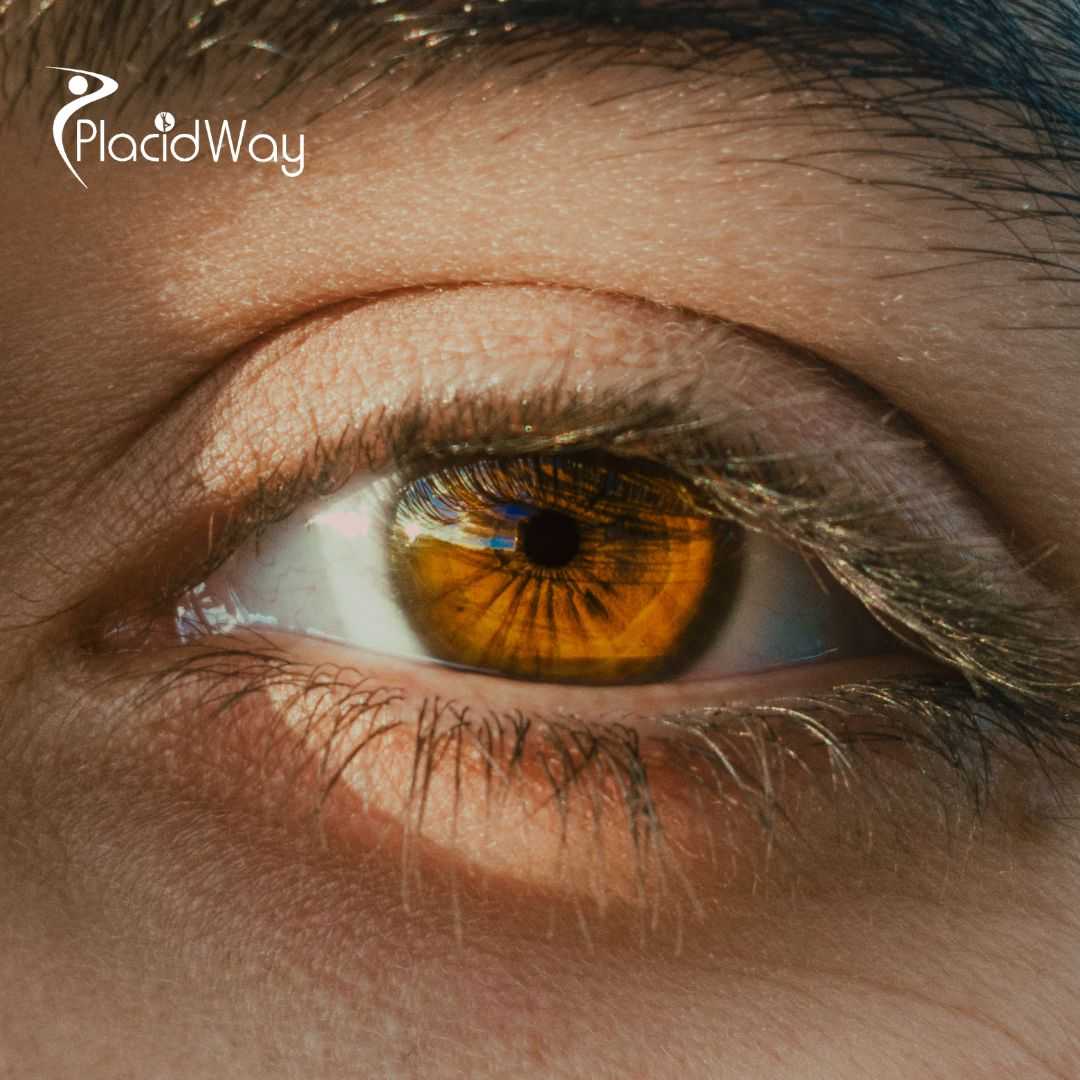 Lasik Eye Surgery Package in Istanbul, Turkey for International Patients Seeking Vision Correction
