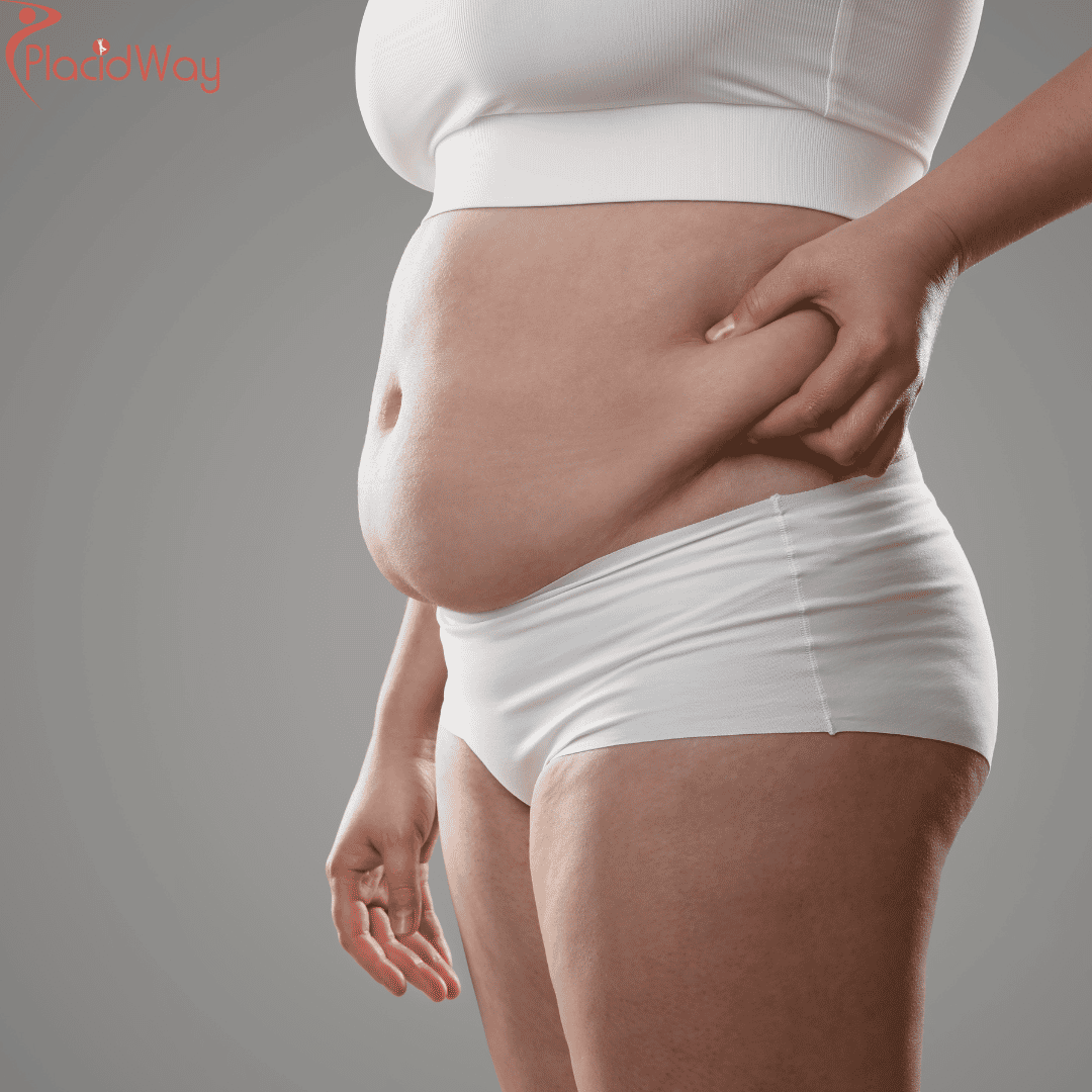 How Much Does Bariatric Surgery Cost in India?