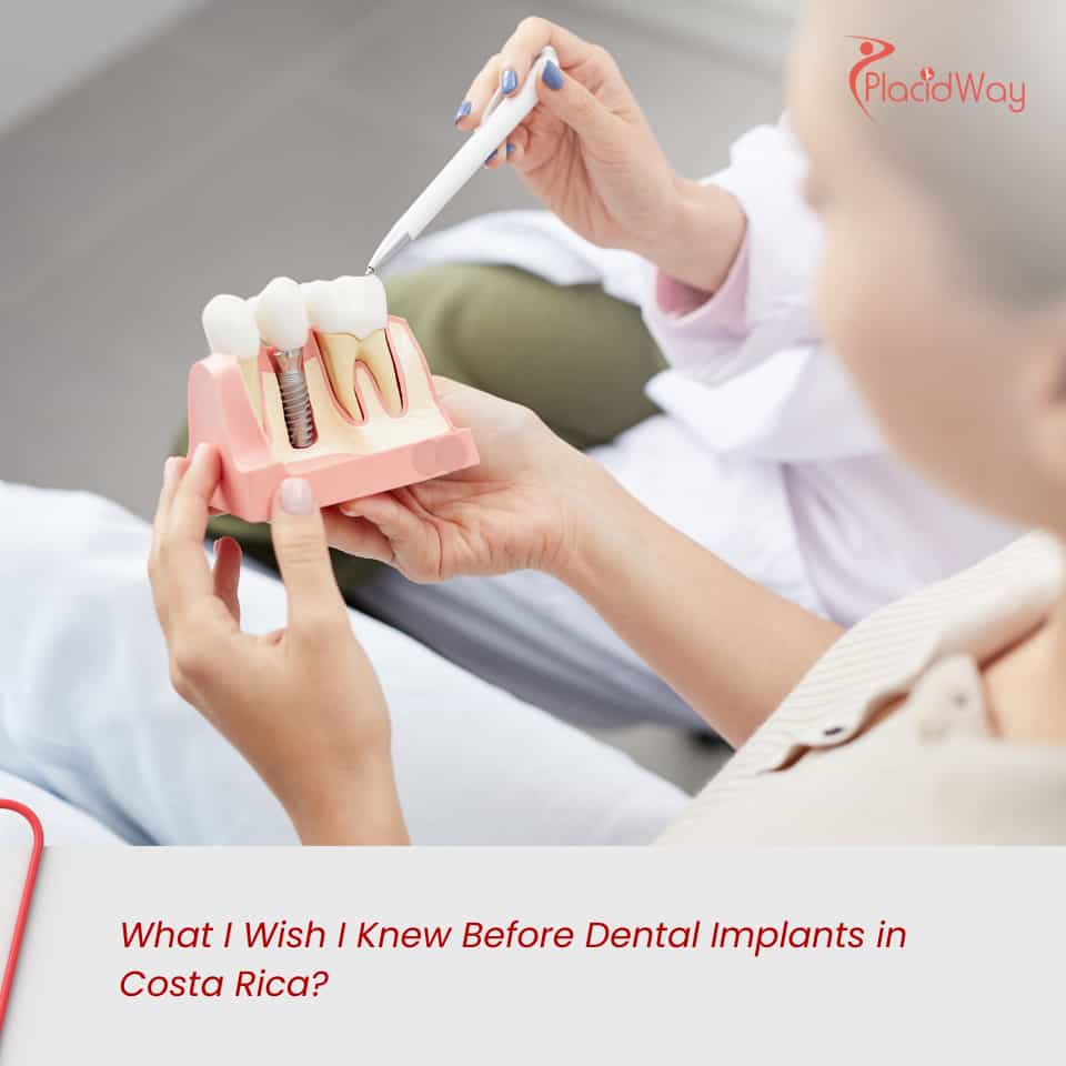 What I Wish I Knew Before Dental Implants in Costa Rica?