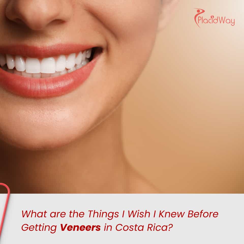 What are the Things I Wish I Knew Before Getting Veneers in Costa Rica?