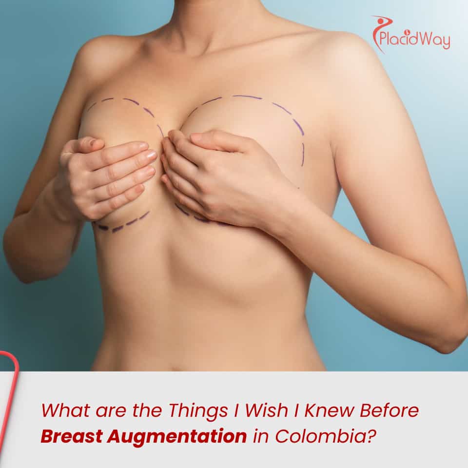What are the Things I Wish I Knew Before Breast Augmentation in Colombia?
