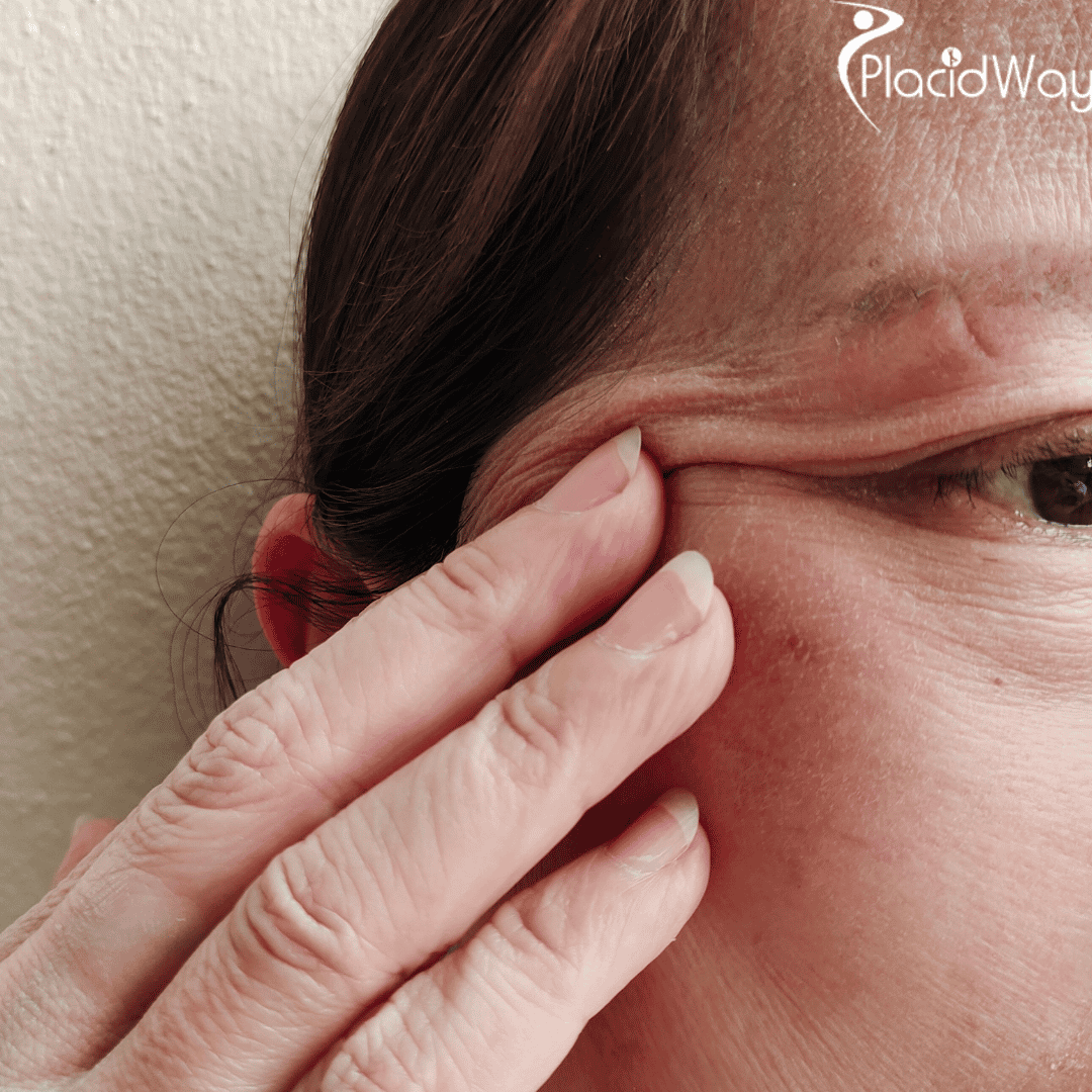 ¿Cómo pueden los cirujanos oculoplásticos en México ofrecer tratamientos oculares asequibles y de alta calidad?