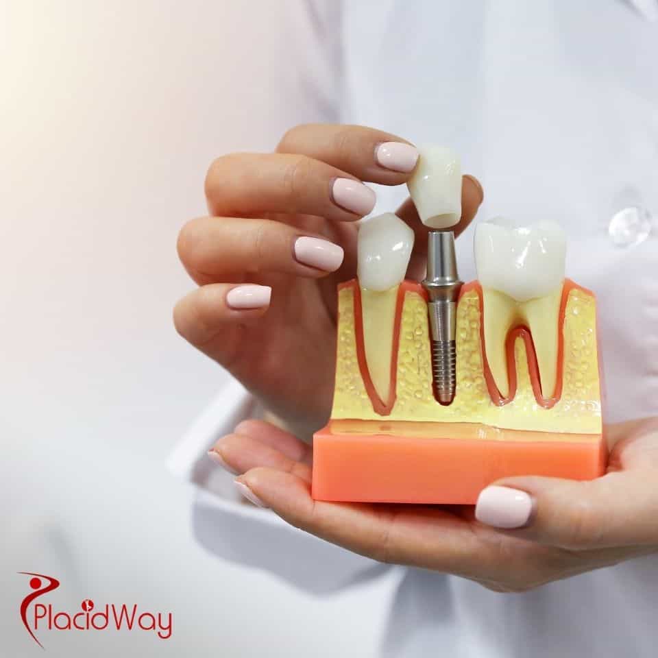 Who are the most reputable implant dentists in Costa Rica for medical travelers?