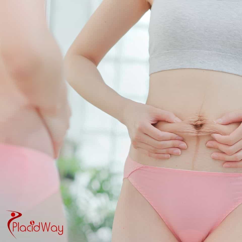 How much is a mommy makeover in Turkey?