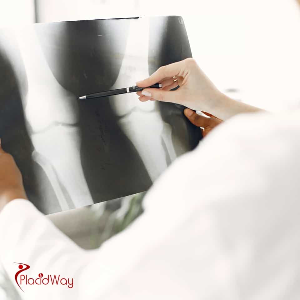 Which Is The Best Orthopedic Hospital In The World?
