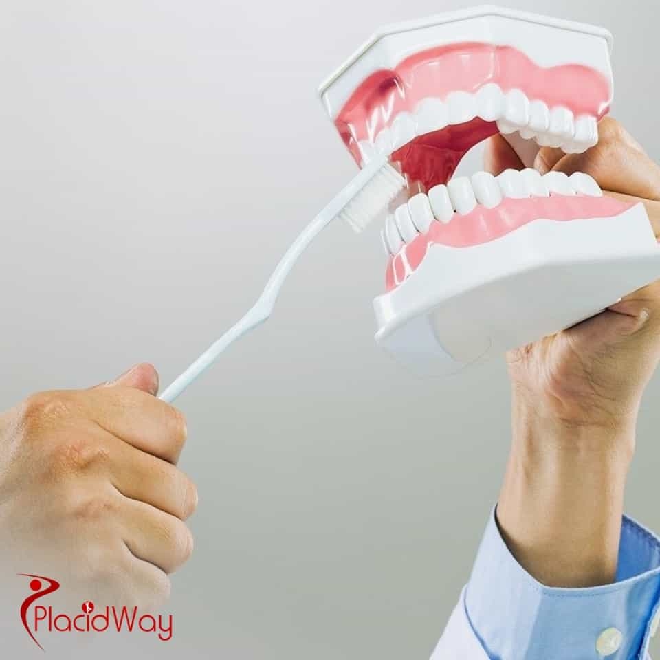 Was beinhalten typische Komplettpakete für Zahnimplantate in der Türkei?