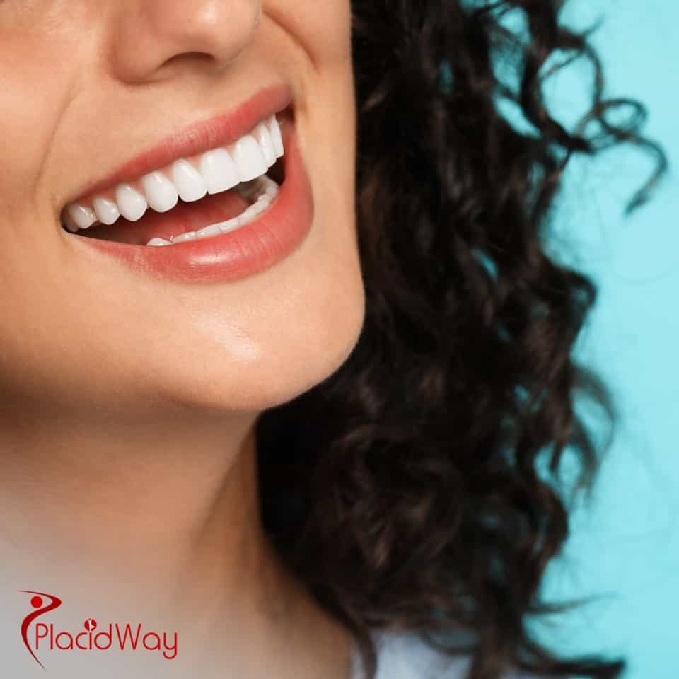 Which Colombian Cities Are Best Known For High-Quality Veneer Treatments?