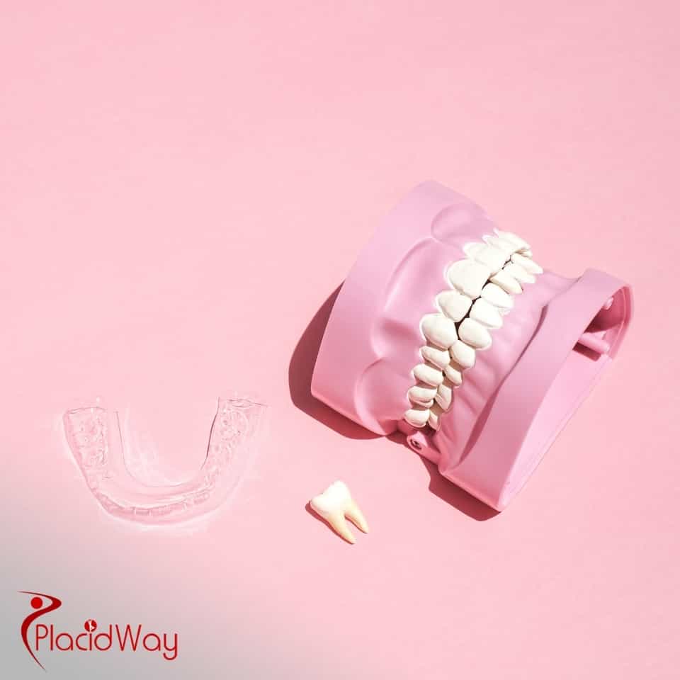 Welche Kliniken in Izmir bieten Emax-Zahnkronen an und was kosten sie?