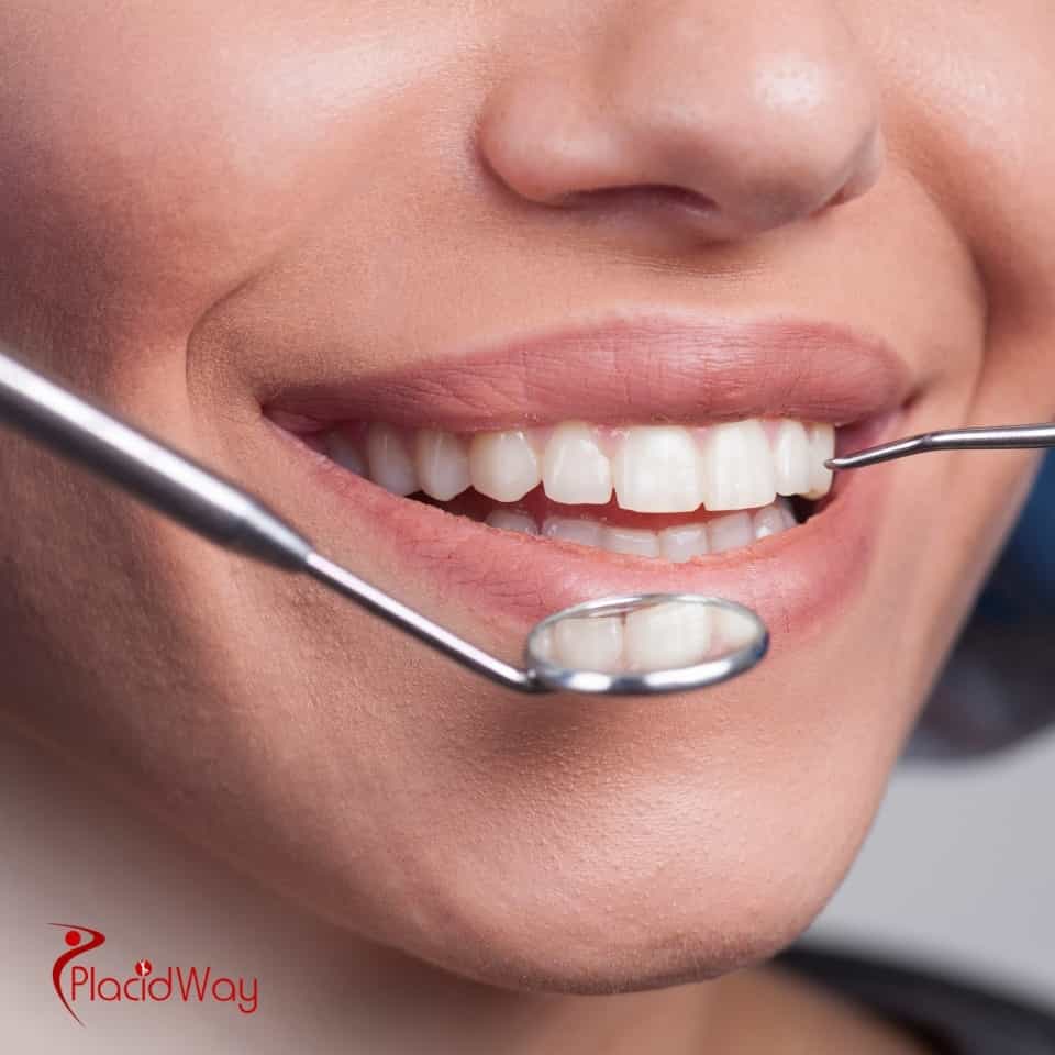 Who Are The Top Dentists In Pattaya, Thailand?