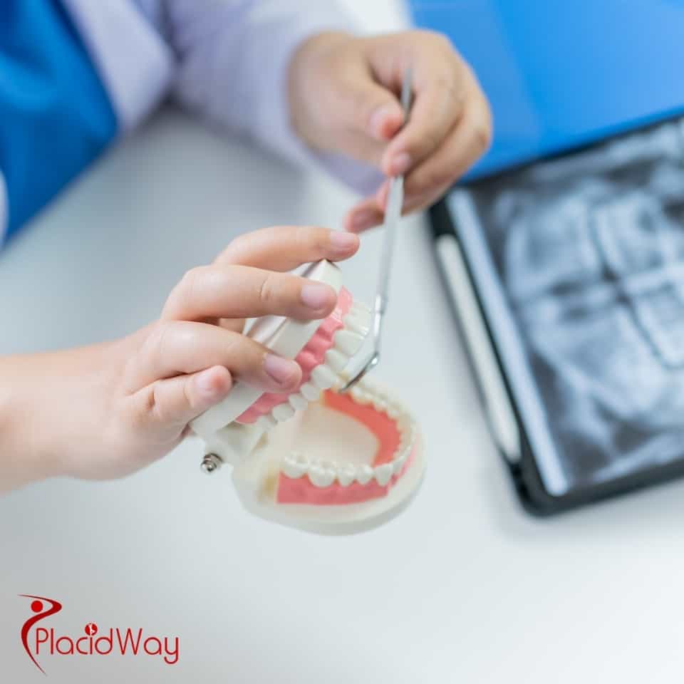 What Is The Average Cost Of A Dental Crown In Costa Rica?