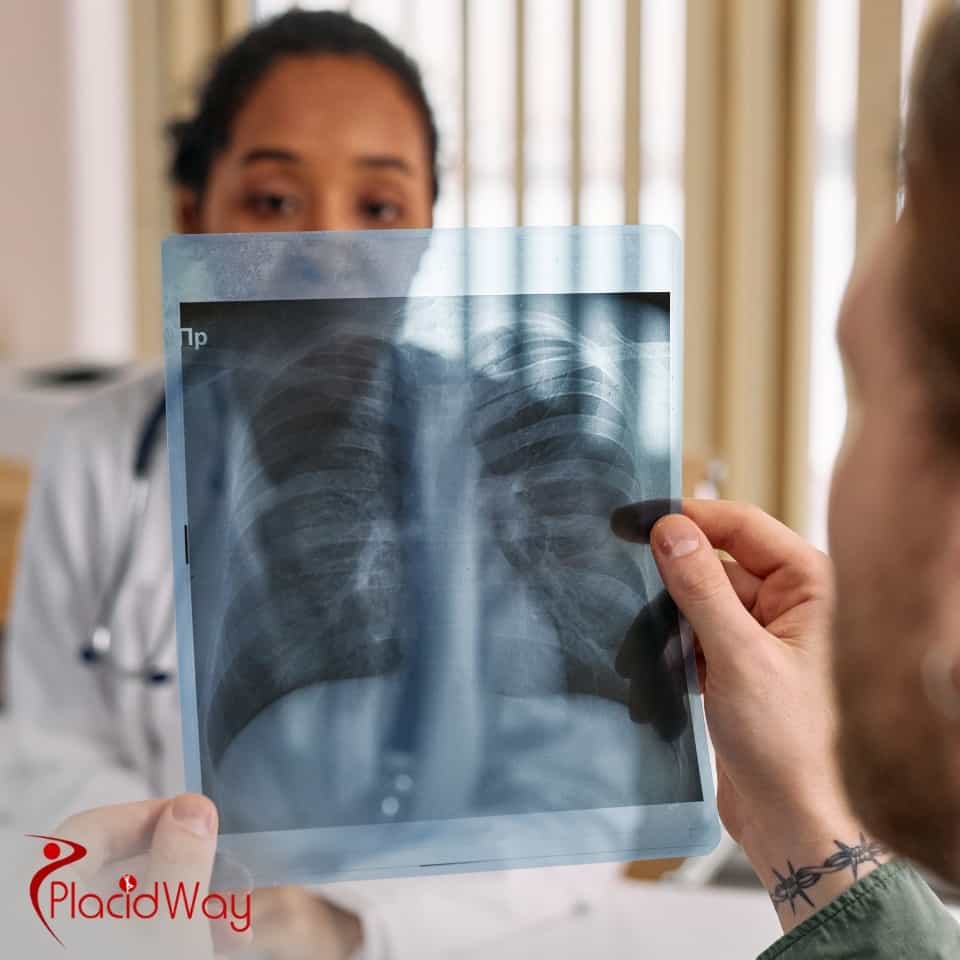 What Are The Treatment Options For Lung Cancer?