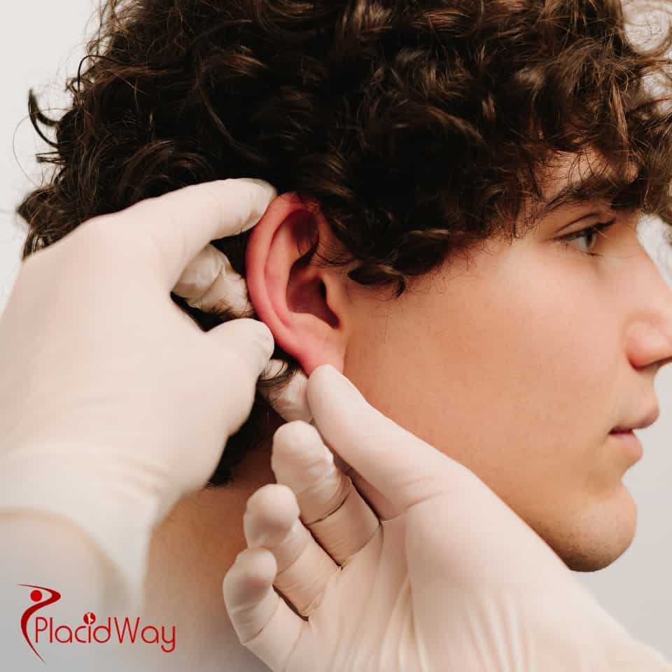 What Should I Know About Getting Otoplasty In Colombia?