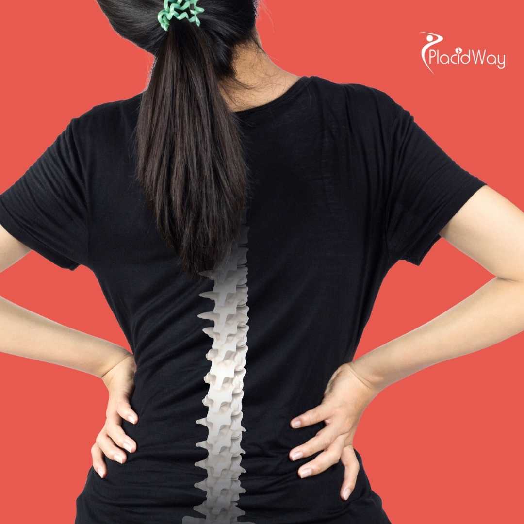How Do I Choose the Best Hospital for Spine Surgery in Mexico?