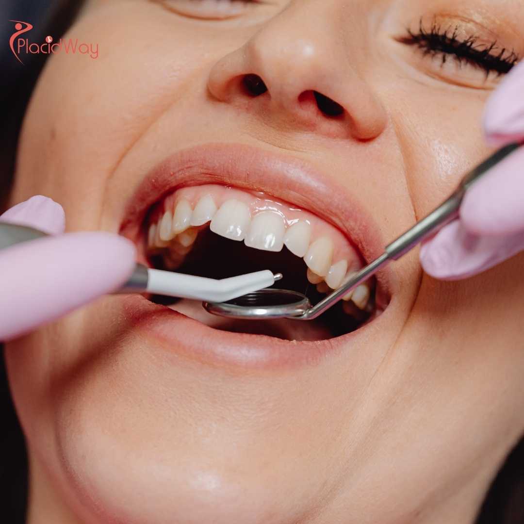 How Much Does a Zirconia Crown Cost in Colombia?