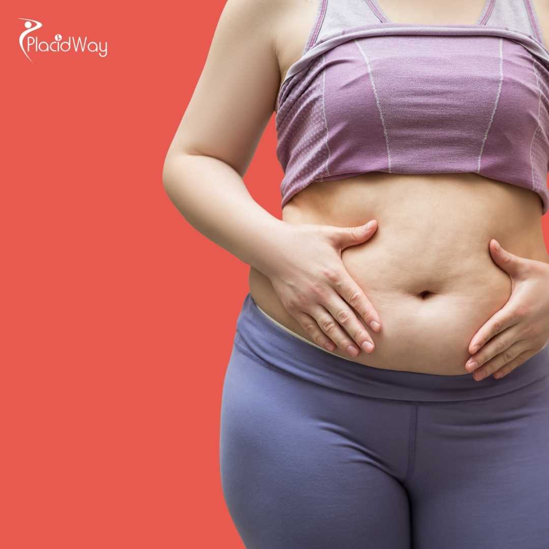 How Long Do I Need to Be in Thailand for a Mommy Makeover?