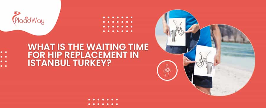 What Is The Waiting Time For Hip Replacement In Istanbul Turkey?