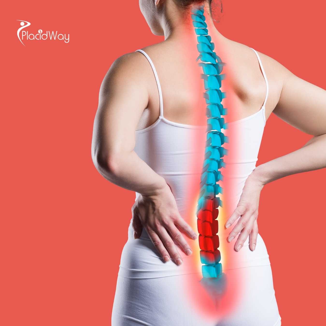 What Are the Risks of Getting Spinal Fusion in Mexico?