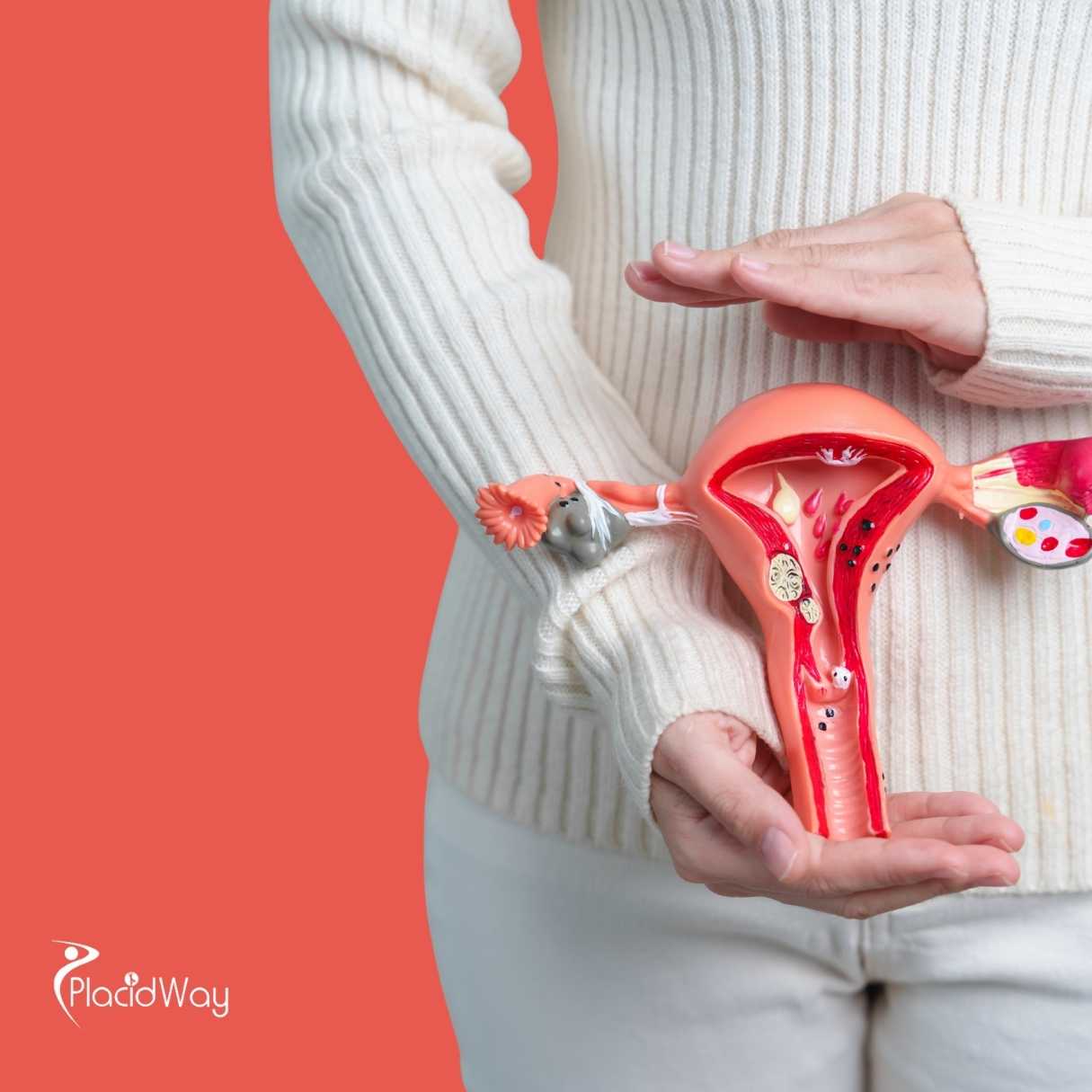 Is PRP for Ovaries Safe in Mexico?