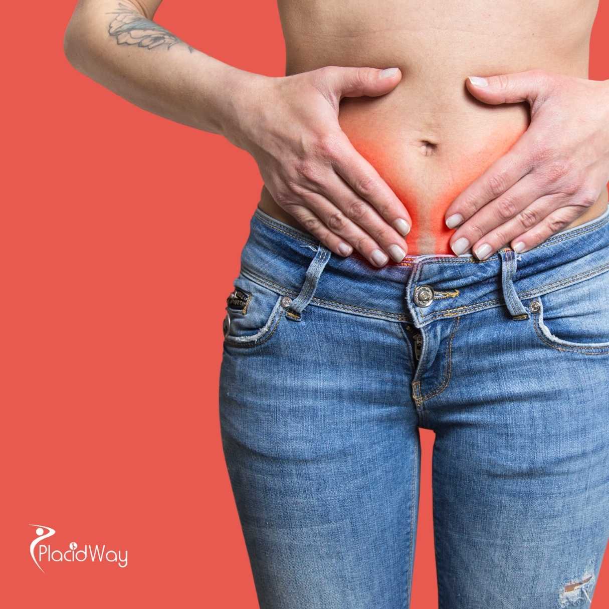 Can Stem Cell Therapy for Ovarian Rejuvenation in Mexico Improve Fertility?