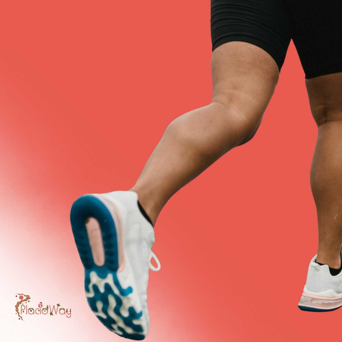 What Is the Recovery Process for Calf Implants in Mexico?