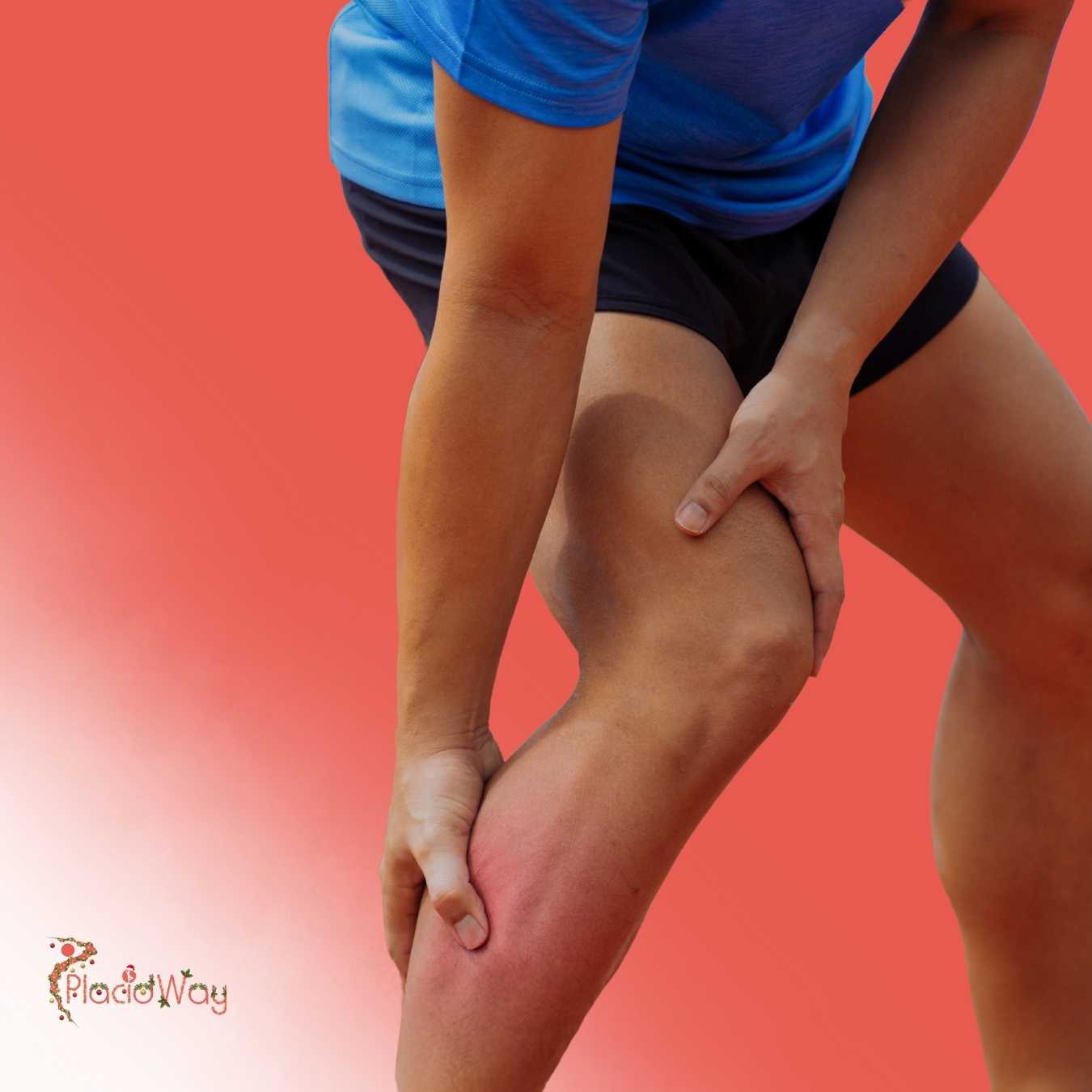 What Are the Risks of Getting Calf Implants in Mexico?
