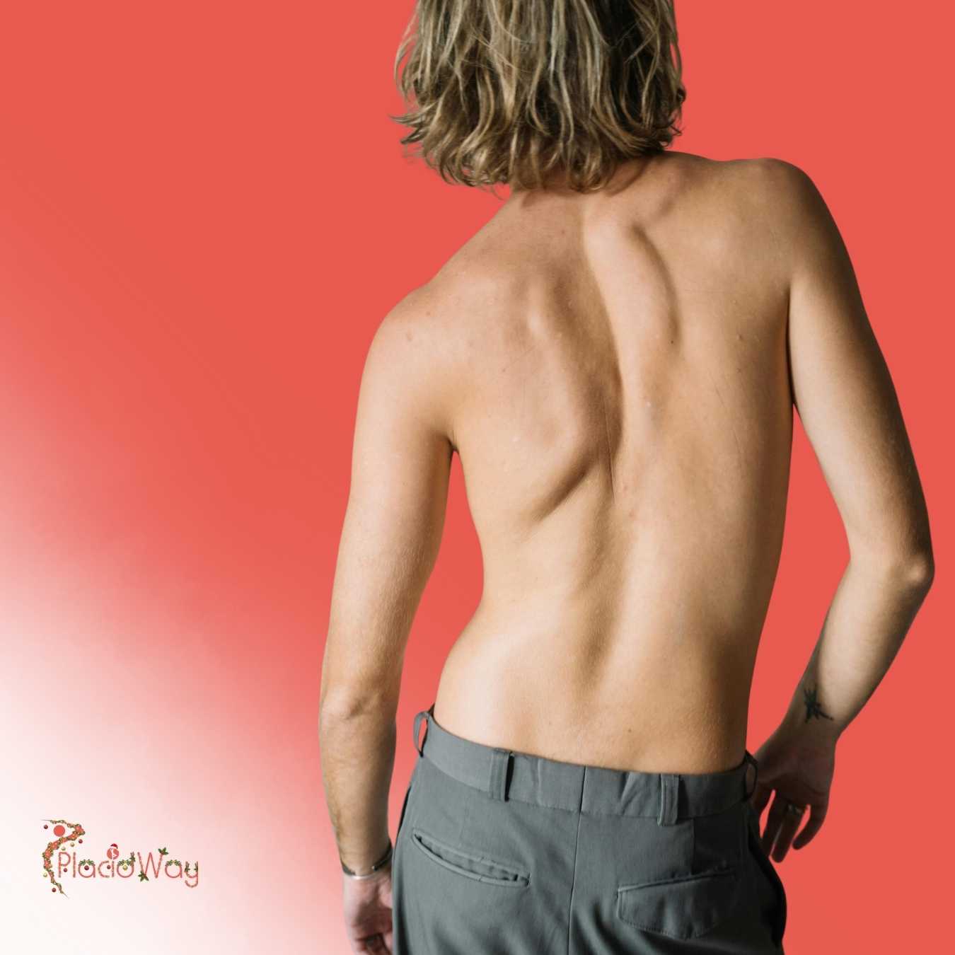 What Is the Recovery Period for a Laminectomy in Mexico?