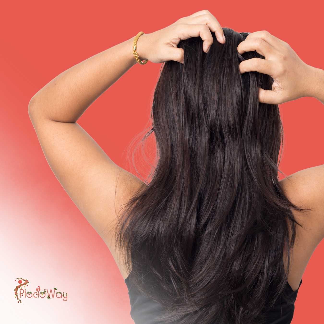 What Is the Recovery Time for a Hair Transplant in Mexico?