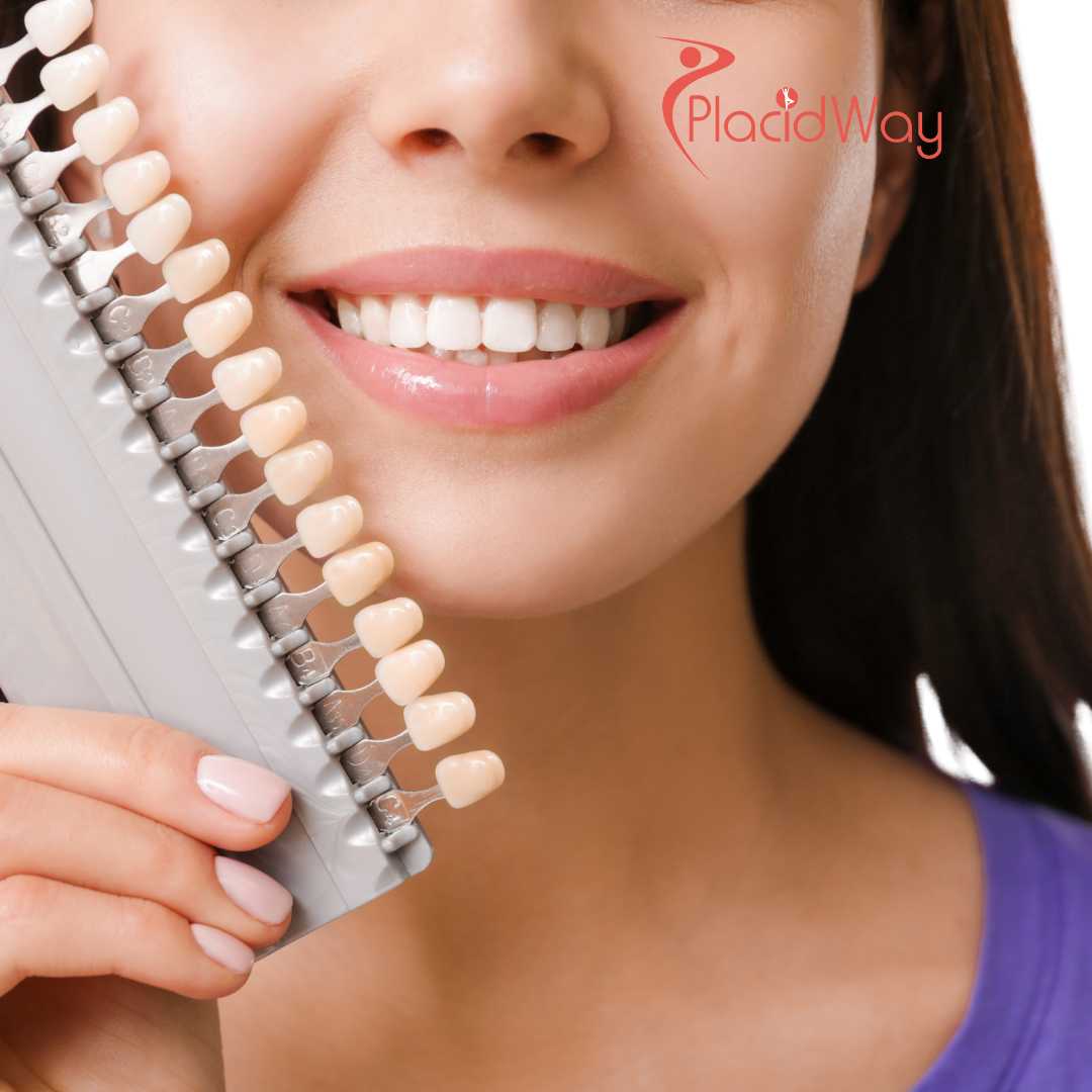 How Much Do Laminate Veneers Cost in South Korea?