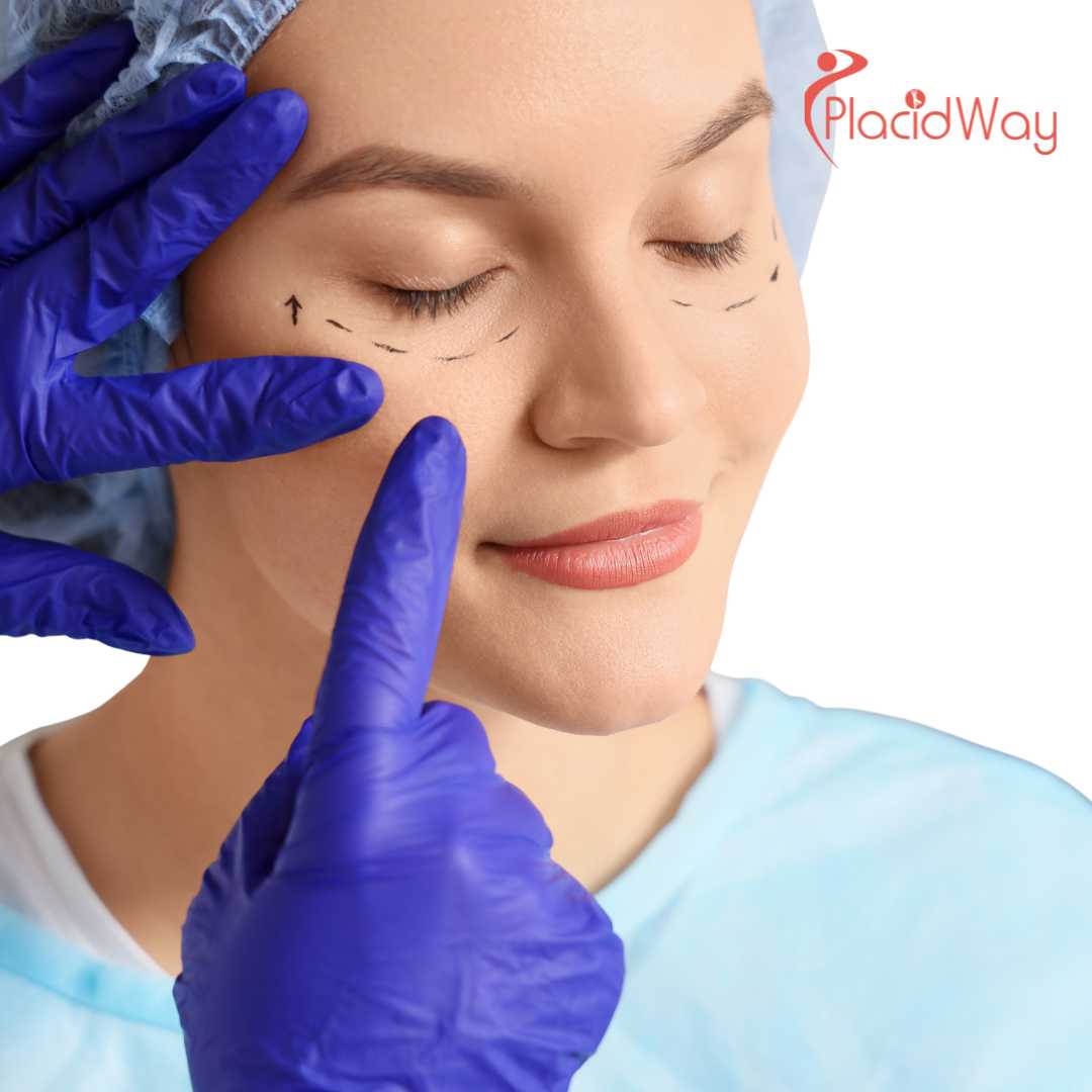 Is Thread Lifting Effective in Korean Aesthetic Clinics?