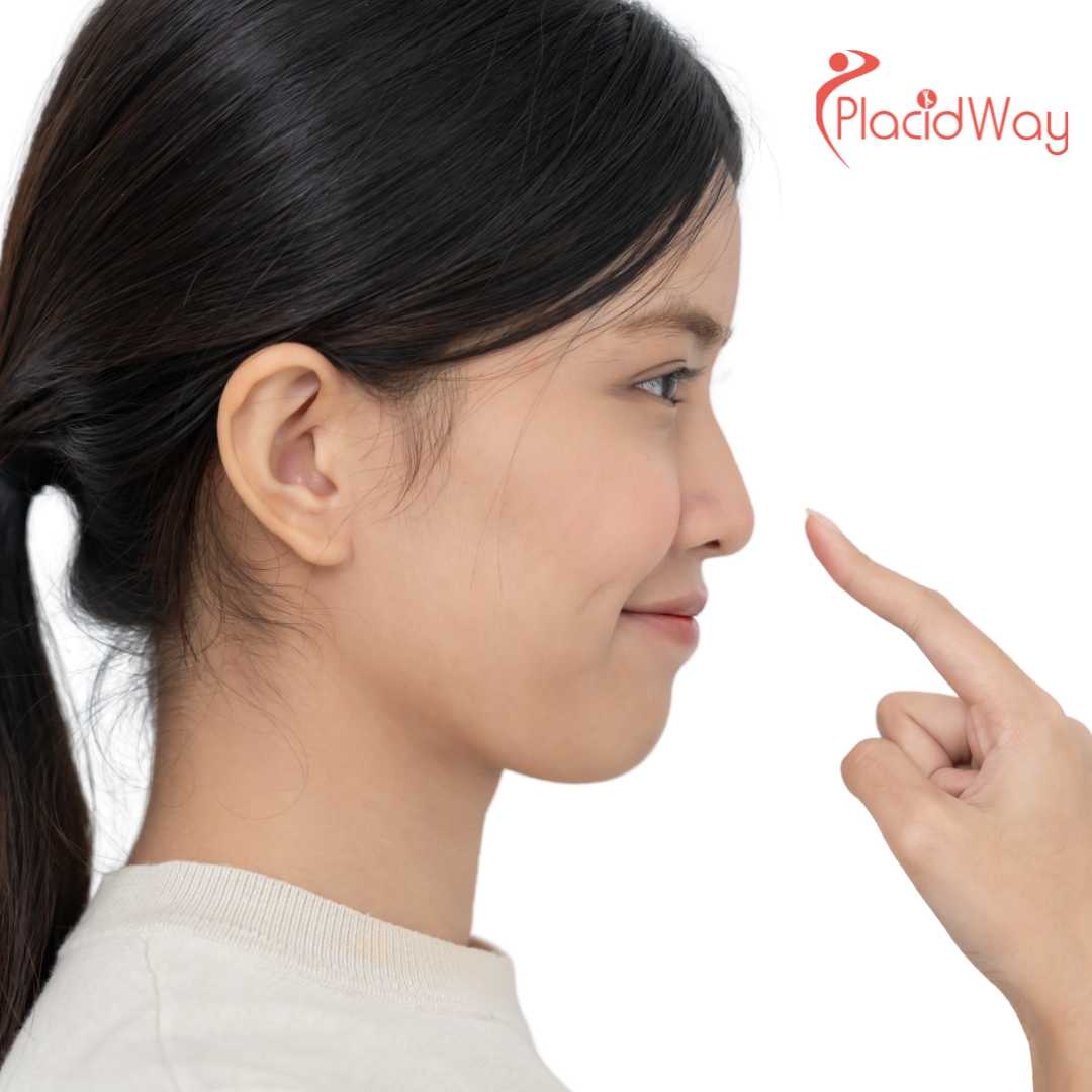 What Is Tip Plasty and Is It Common in South Korea Clinics?